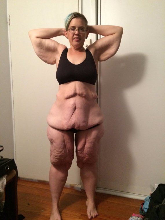 Люди в сети делятся своими шокирующими снимками после похудения. Фото: fishki.net