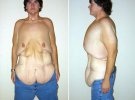 Люди в сети делятся своими шокирующими снимками после похудения. Фото: fishki.net