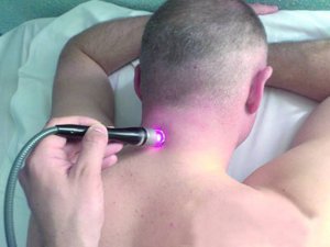  У клініці "Меднеан” для лікування дистонії застосовують високочастотний лазер 