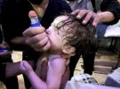 Внаслідок хімічної атаки у сирійській Думі загинули більше 70 чоловік