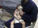 Внаслідок хімічної атаки у сирійській Думі загинули більше 70 чоловік