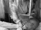 Травень 1986 року, Молодий тесляр, який допомагав боротися з вогнем на Чорнобильській атомній станції, лікується від опіків та радіації в лікарні №6 Москви.
