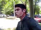 В Одесі напали на лідера "Автомайдану"