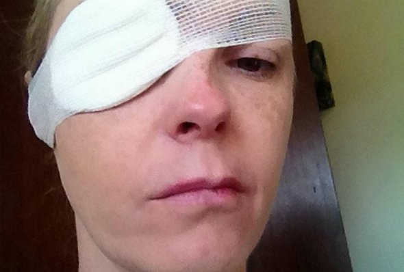 43-річна Рейчел Фоулкс-Девіс і не підозрювала, що її вкусив кліщ