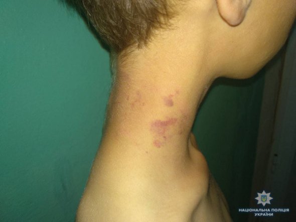 На Луганщині вітчим знущався над 10-річним хлопцем