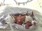 Британка Хінду народила чотирьох близнят на 32-му тижні вагітності
