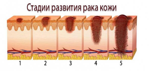 Університетська клініка м Фрайбурга. в Німеччині пропонує лікування лейкозу, меланоми, раку грудей, підшлункової залози та інших