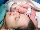 Фотограф фіксує перші миті життя новонароджених