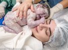 Фотограф фиксирует первые мгновения жизни новорожденных