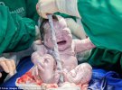 Фотограф фиксирует первые мгновения жизни новорожденных
