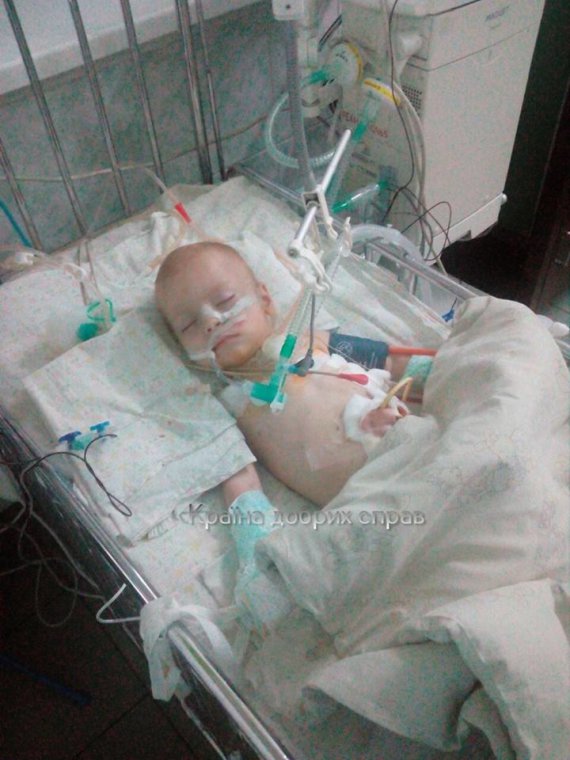 В Кропивницкому Артем Савченко проглотил батарейку-таблетку. Ребенка в тяжелом состоянии доставили в центральную местную больницу