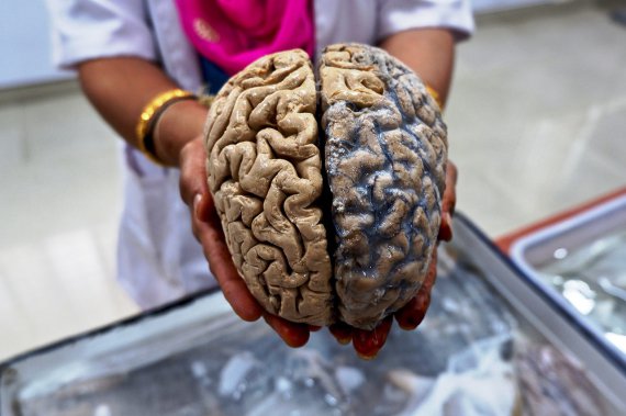 В Индии работает музей мозга. Здесь можно не только посмотреть, но и подержать человеческие мозги в руках