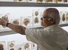 В Індії працює музей мозку. Тут можна не лише подивитись, а й потримати людські мізки в руках