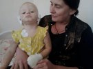 В Славянске Донецкой области собака искалечил 2-летнюю мальчика. Его мать в тот момент спала