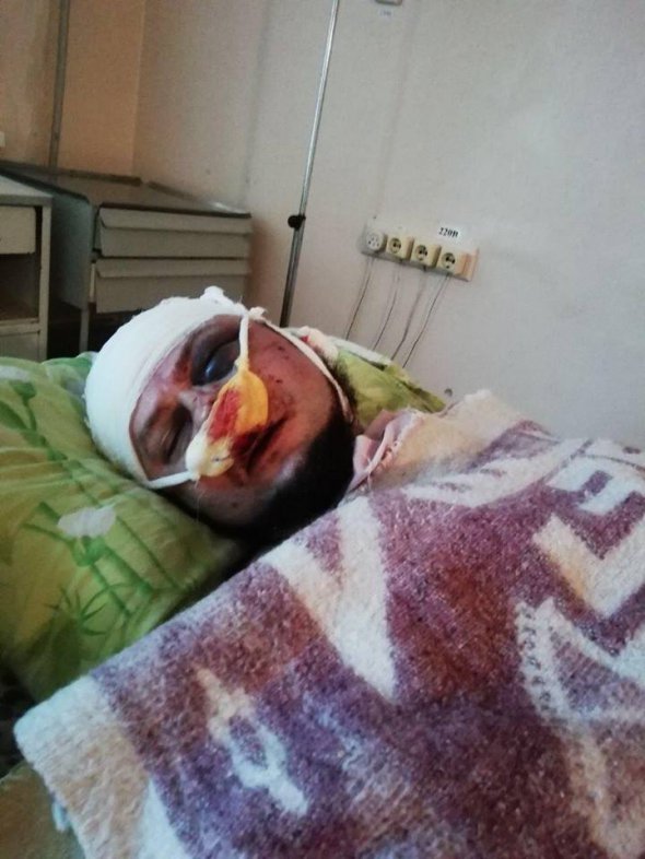 У Павлограді Дніпропетровської області невідомі напали на активіста "Національних дружин" Юрія Малімонова. Він знаходиться в лікарні