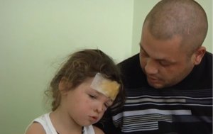 Микола Півторак із села Михайлівка Олександрівського району Кіровоградської області сидить біля доньки 4-річної Таїси в хірургічному відділенні обласної дитячої лікарні. Дівчинка має опіки рук та обличчя. Потребує тривалої реабілітації