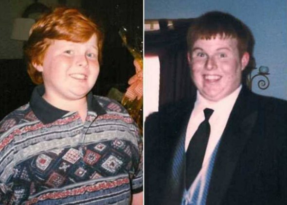 На фото слева Кейси в детстве, справа — по окончанию средней школы