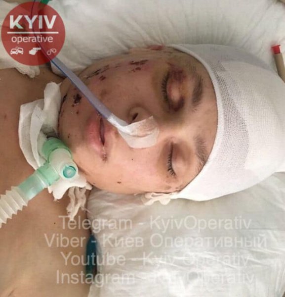 Травмы девушка получила при падении с высоты. Фото: facebook.com/KyivOperativ