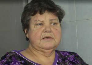 Олена Жаковська із села Петропавлівка Братського району Миколаївської області вивихнула ногу 10 січня. За два дні кінцівка напухла і почорніла. Був ризик зараження крові