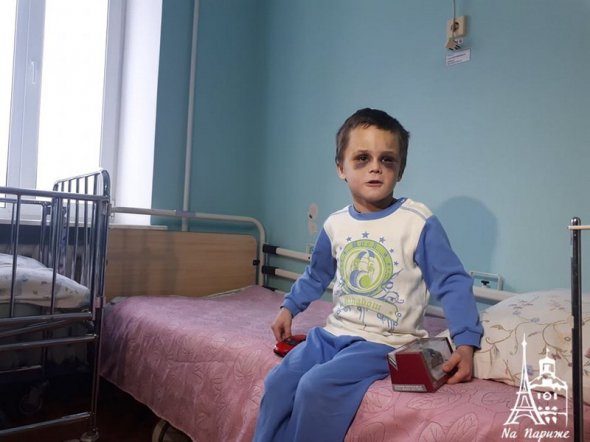 Вінниччина: лікарі розповіли про стан хлопчика, якого жорстоко відгамселив батько