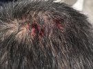 В Кременчуці з даху багатоповерхівки впала крижана брила і пробила голову юнаку