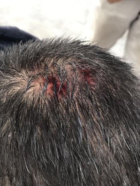 В Кременчуці з даху багатоповерхівки впала крижана брила і пробила голову юнаку