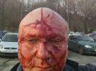 21 февраля доґхантера Алексея Святогора жестоко избили возле метро Лукьяновская в Киеве