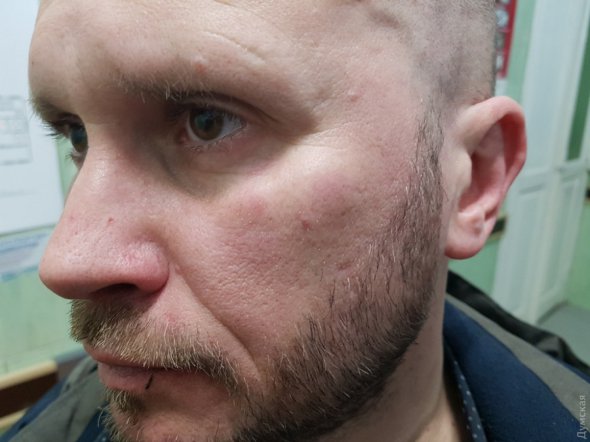 В Одессе напали на журналиста Александра Новицкого. Фото: Думская