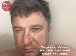 Экс-директор "Ассоциации внешней рекламы Киева" Максим Чаленко избил жену и на глазах у детей выбросил собаку из окна 12 этажа