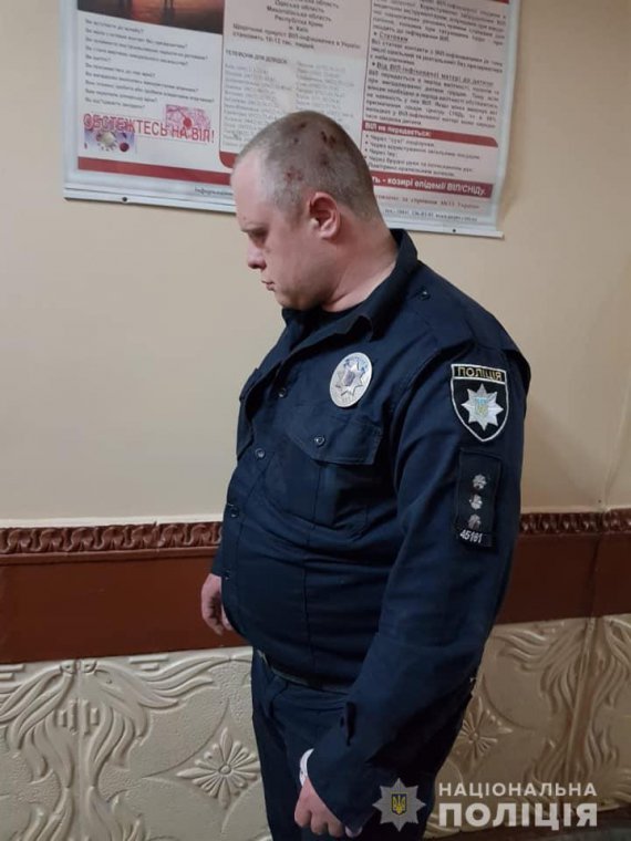 В Каменском Днепропетровской злоумышленник молотком и ножом напал на полицейских