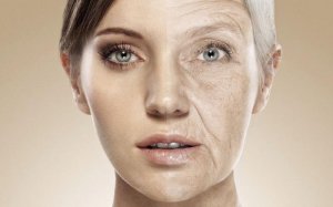 Існує чотири основних типи старіння шкіри, кожен з яких - це наслідок неправильної дієти і непомірного вживання їжі.