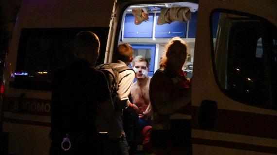 В Киеве произошла драка с поножовщиной, результате которой ранения получил 18-летний парень