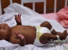 Сейби — самый маленький ребенок, выживший в результате ранних родов.