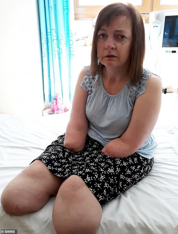 Англичанка Кейтлин Мейхер внезапно потеряла сознание, когда ухаживала мать. Впоследствии у женщины обнаружили инфекцию, которую поедала ткани ее тела