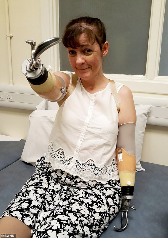 Чтобы спасти ей жизнь врачи ампутировали руки и ноги
