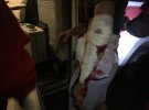 Авто волонтерки попало в аварию