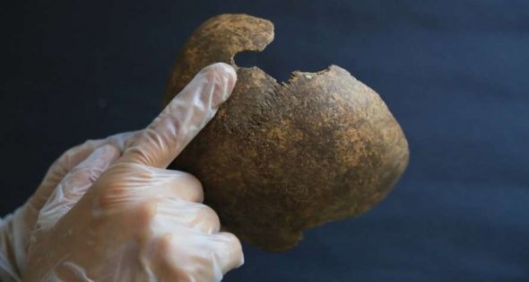 Древние врачи провели успешную операцию на черепе человека 2,2 тыс. лет назад