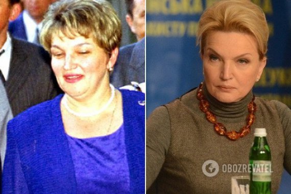 Пластичну операцію вона зробила ще у 2007 році