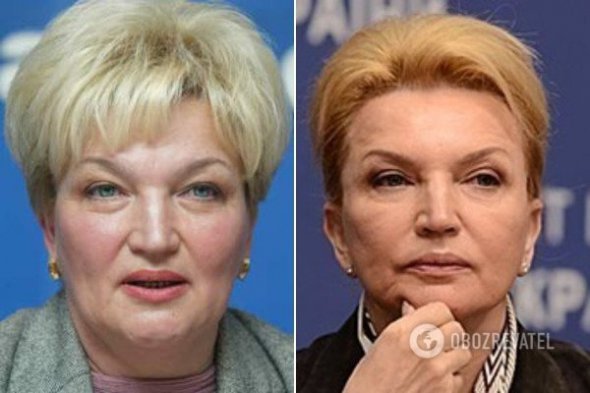 Пластичну операцію вона зробила ще у 2007 році