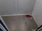 У Одесі вчительку англійської мови Тетяну Бурчанову порізав власний чоловік Гелан Фейсал Хазаль