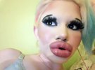 22-летняя студентка из Боргарии Андреа Емилова Иванова хочет иметь самые губы в мире. Говорит, что мечтала об этом с детства