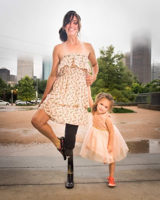 Американка Кейтлин Коннор пожертвовала ногой, чтобы родить дочь