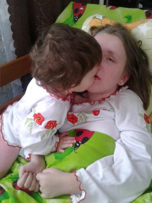 Судоми та прикутість до ліжка: 13-річній Анастасії Пащенко потрібна допомога