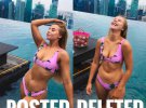 Чессі Кінг показує, як виглядає справжнє жіноче тіло за межами Instagram. 