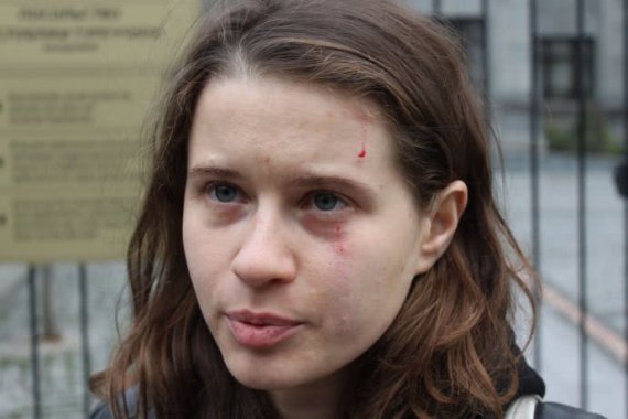 Пострадавшая активистка культурологиня Анна Цыба утверждает, что на нее напали сотрудники посольства
