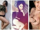Ким Кардашьян продемонстрировала в сети свое полуобнаженное тело с признаками псориаза