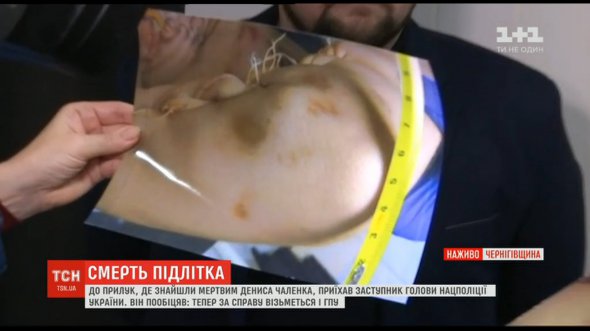Батьки загиблого у Прилуках на Чернігівщині  14-річного Дениса Чаленка  показали сліди побиття на тілі сина