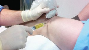 Ортоплазму застосовують при артрозах, артритах, подагрі, остеохондрозі, переломах і міжхребцевих грижах