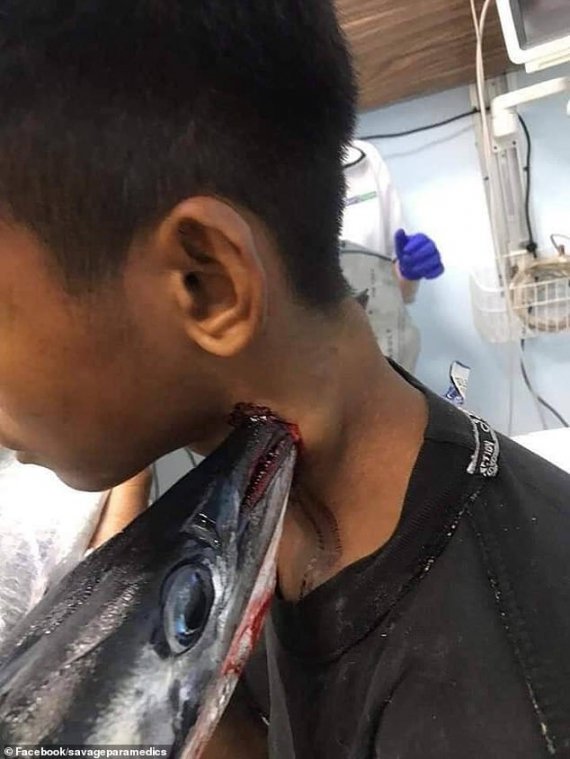 Риба-голка проштрикнула шию 16-річному індонезійцю 