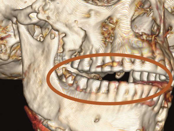 20-річна єгиптянка, що жила 1,6 тис років тому була вбита ножем у спину, та мала додатковий зуб